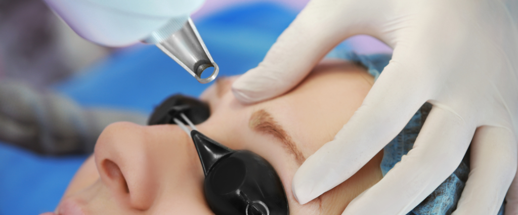 TATTOO REMOVAL 1 TATTOO REMOVAL