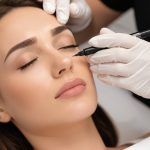 mild discomfort during procedure