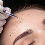 ultra fine hair stroke implantation